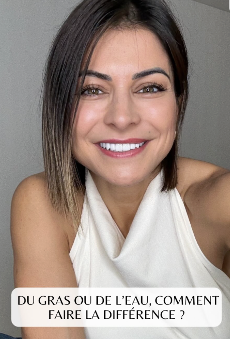 Rétention d’eau ou de graisse : comment les reconnaître en 3 signes ?